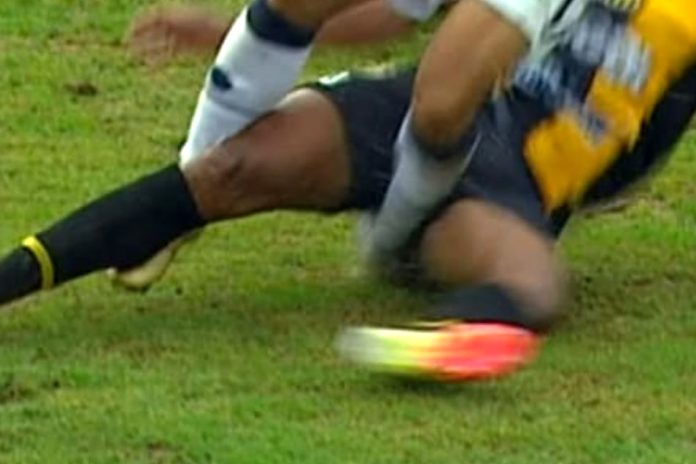 Novorizontino-SP 1×1 Remo (Marcelinho) – Foto: Reprodução (CBF)